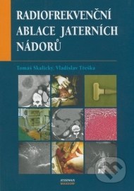 Radiofrekvenční ablace jaterních nádorů