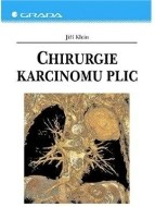 Chirurgie karcinomu plic - cena, srovnání