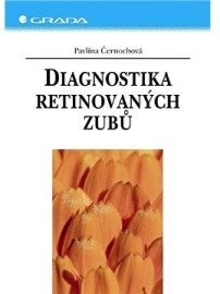 Diagnostika retinovaných zubů