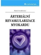 Arteriální revaskularizace myokardu - cena, srovnání