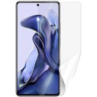 Screenshield XIAOMI 11T na displej (XIA-11T-D) - cena, srovnání